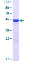 Human CRYBB2 Protein (Recombinant GST)