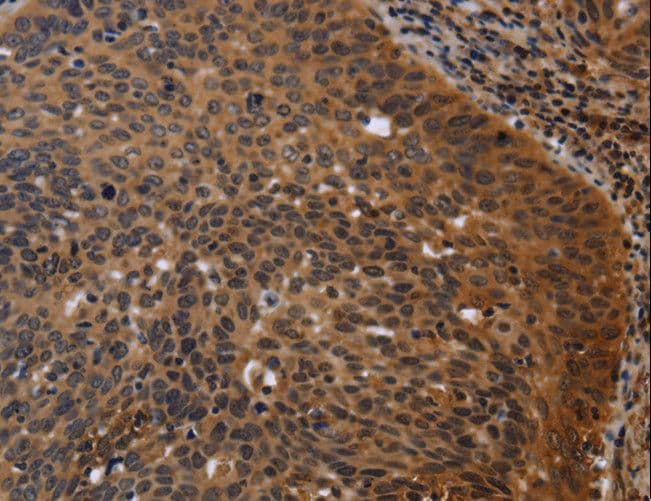 Polyclonal Rabbit anti-Human FGB / Fibrinogen Beta Chain Antibody (IHC, WB)