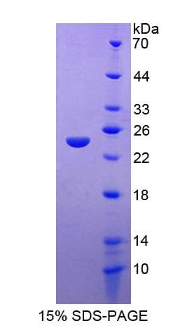 Human FAM20A Protein (Recombinant His-S)