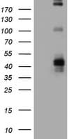 FCER2 / CD23 Antibody (clone OTI9B6)
