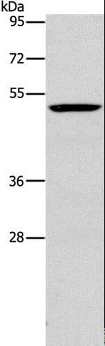PLIN2 / ADFP / Adipophilin Antibody