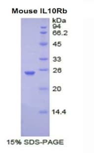Mouse IL10RB Protein (Recombinant His)