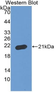 AATK / AATYK Antibody (aa1216-1374, FITC)