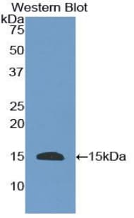 EGF Antibody (aa367-489)