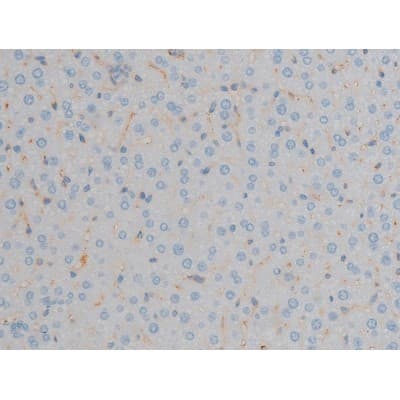 MAPK3 / ERK1 Antibody (phospho-Tyr204,pThr202)