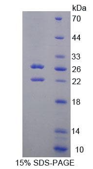 Human SPHK2 Protein (Recombinant His-T7, N-terminus)