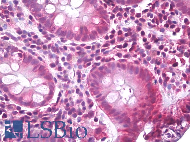 IHC-plus™ EIF4B Antibody (Ser422)