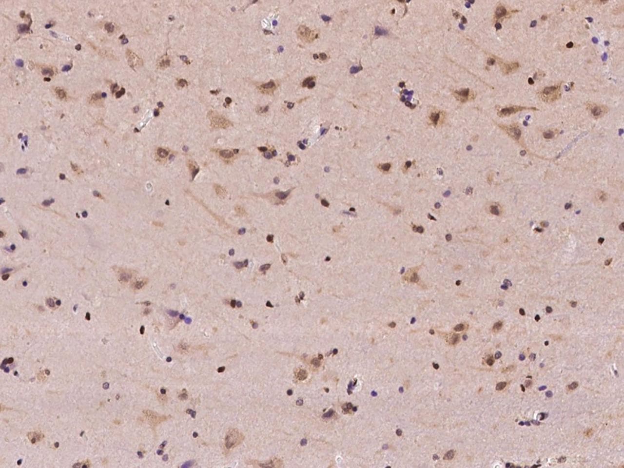 RPA3 Antibody