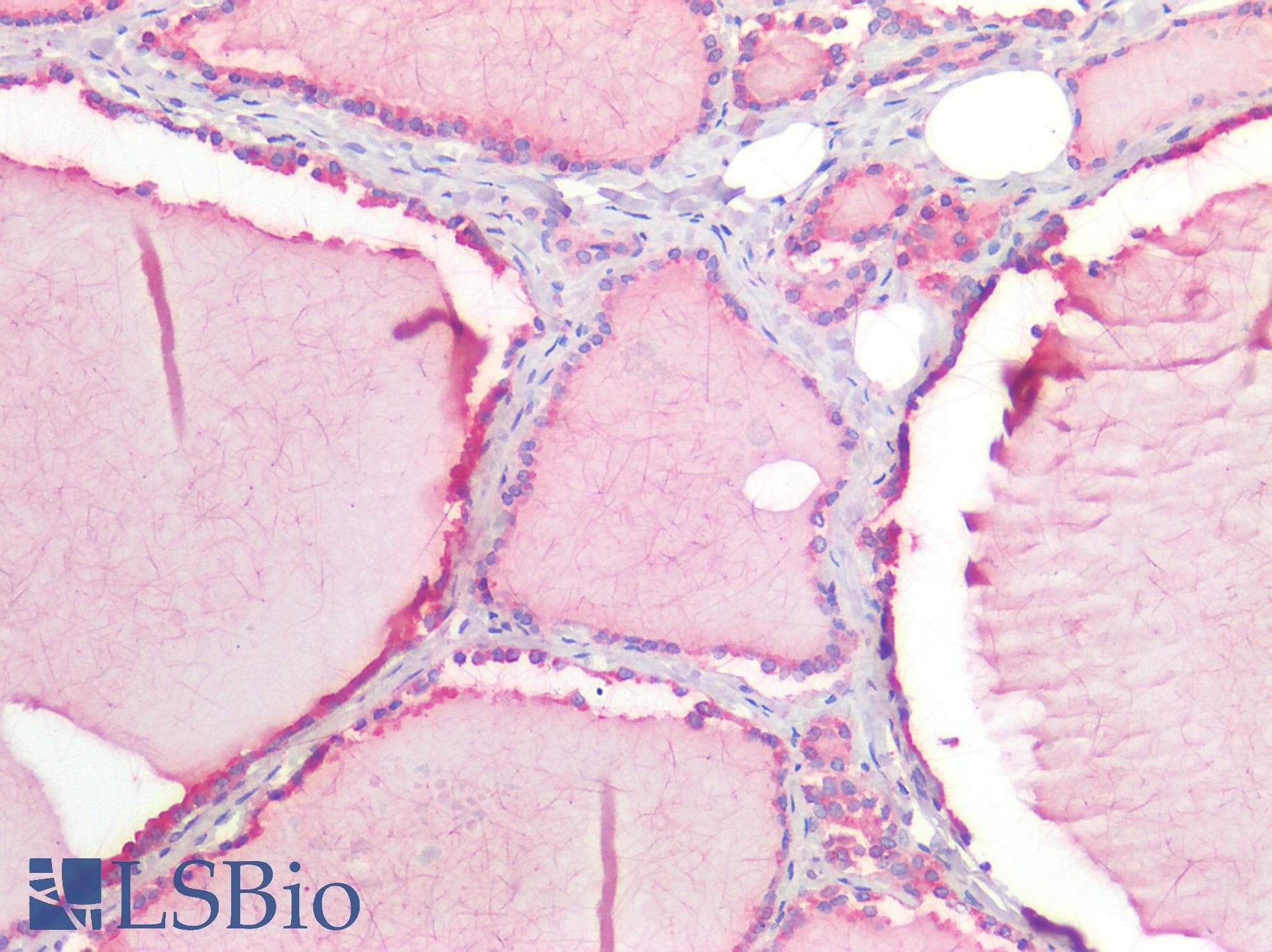 PathPlus™ Polyclonal Rabbit anti-Human IFIH1 / MDA5 Antibody (IHC)