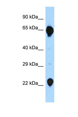 RAG2 / RAG-2 Antibody (C-Terminus)