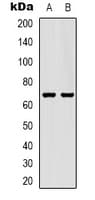 SLC6A1 / GAT-1 Antibody