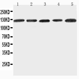 ITGA7 / Integrin Alpha 7 Antibody (aa1123-1139)