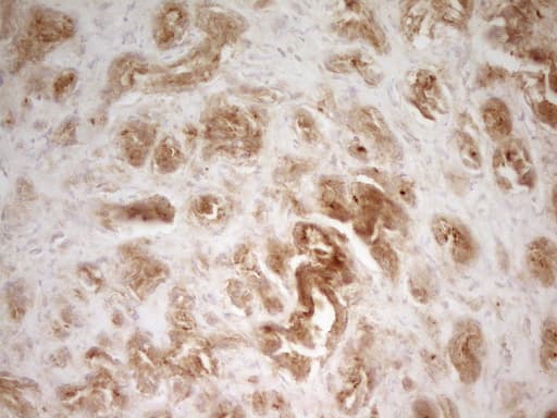 Monoclonal Mouse anti-Human PAK4 Antibody (clone OTI1C7, aa1-308, IHC, WB)