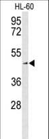 SLC1A5 / ASCT2 Antibody (aa186-214)