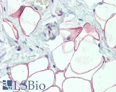 IHC-plus™ DCBLD2 Antibody
