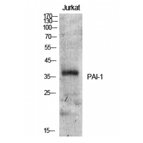 Polyclonal Rabbit anti-Human SERPINE1 / PAI-1 Antibody (Internal, IHC, WB)