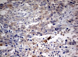 STK11 / LKB1 Antibody (aa1-236, clone OTI0A3)
