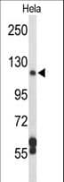 Dipeptidylpeptidase 8 / DPP8 Antibody (aa23-52)