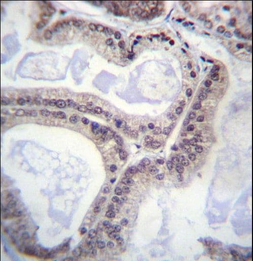 Polyclonal Rabbit anti-Human EIF1AY Antibody (aa1-30, IHC, WB)