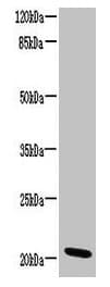 Polyclonal Rabbit anti-Human C15orf57 / CCDC32 Antibody
