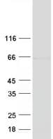 Human EVI2A Protein (Recombinant Myc-DDK (Flag))
