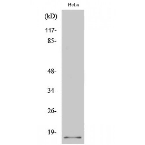 p14ARF / CDKN2A Antibody (40-120 aa, Internal)