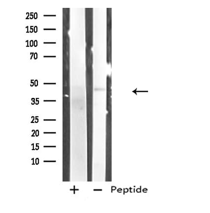 Polyclonal Rabbit anti-Human RRM2B / P53R2 Antibody (IF, WB)