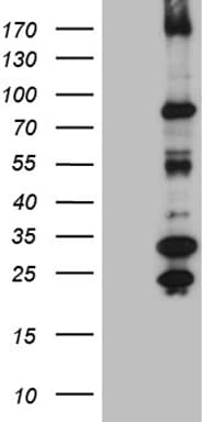 MSH6 Antibody (aa1-280, clone OTI5D1)