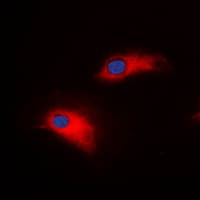 Polyclonal Rabbit anti-Human MMP8 Antibody (C-Terminus, IHC, IF, WB)