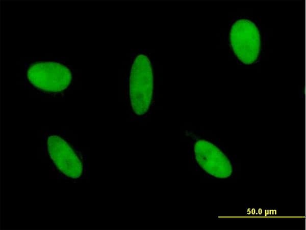 GLI3 Antibody (clone 2C9)