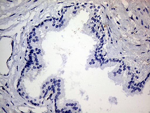 TGM2 / Transglutaminase 2 Antibody (clone OTI4H5, Carrier-free)