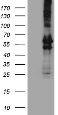 Peripherin Antibody (clone OTI8G3)