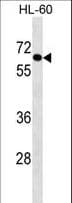 Polyclonal Rabbit anti-Human AIM1L Antibody (aa395-423, WB)