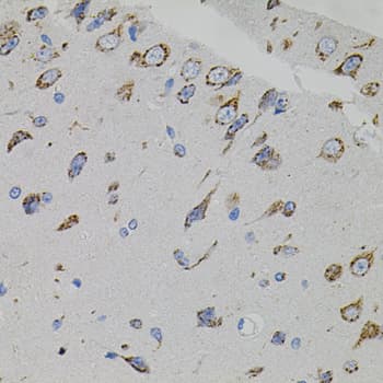 Polyclonal Rabbit anti-Human VEGFC Antibody (IHC, WB)