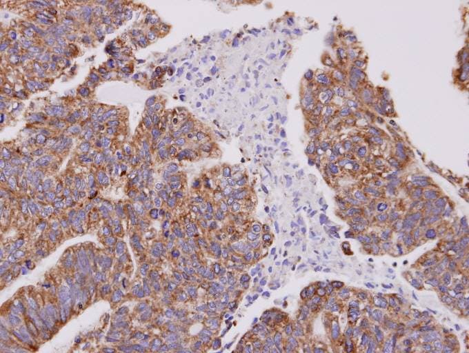 CFL2 / Cofilin 2 Antibody (aa92-166)