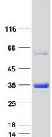 Human APIP Protein (Recombinant Myc-DDK (Flag))