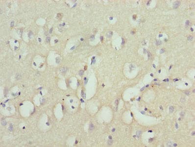 Polyclonal Rabbit anti-Human ZNF177 / PIGX Antibody (IHC)