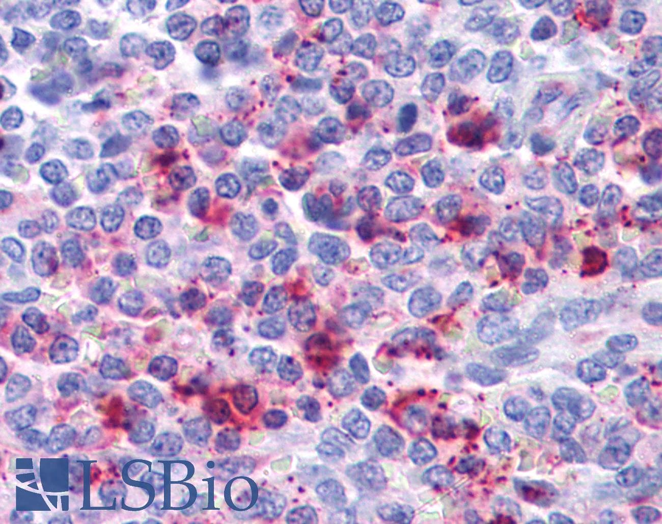 IHC-plus™ CXCR2 Antibody (N-Terminus)