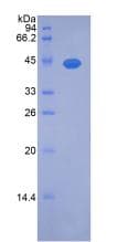 Rat NOG / Noggin Protein (Recombinant His-GST, N-terminus)