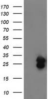FGF21 Antibody (clone OTI1B4)