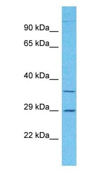 Polyclonal Rabbit anti-Human OR2A7 Antibody (C-Terminus, WB)