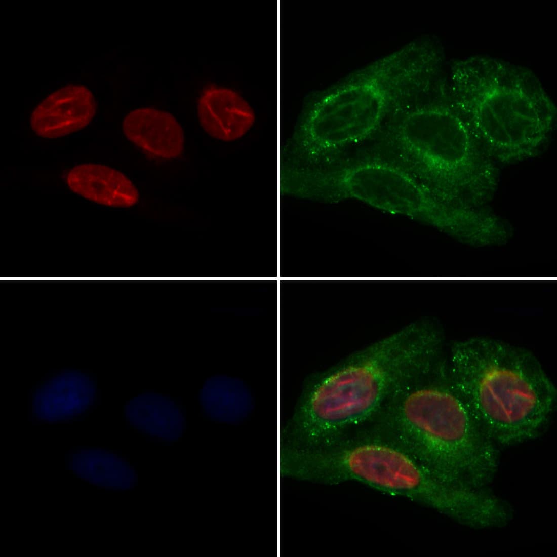 Polyclonal Rabbit anti-Human QKI Antibody (IF, WB)