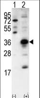 Polyclonal Rabbit anti-Human SNAI1 / SNAIL-1 Antibody (aa9-36, WB)
