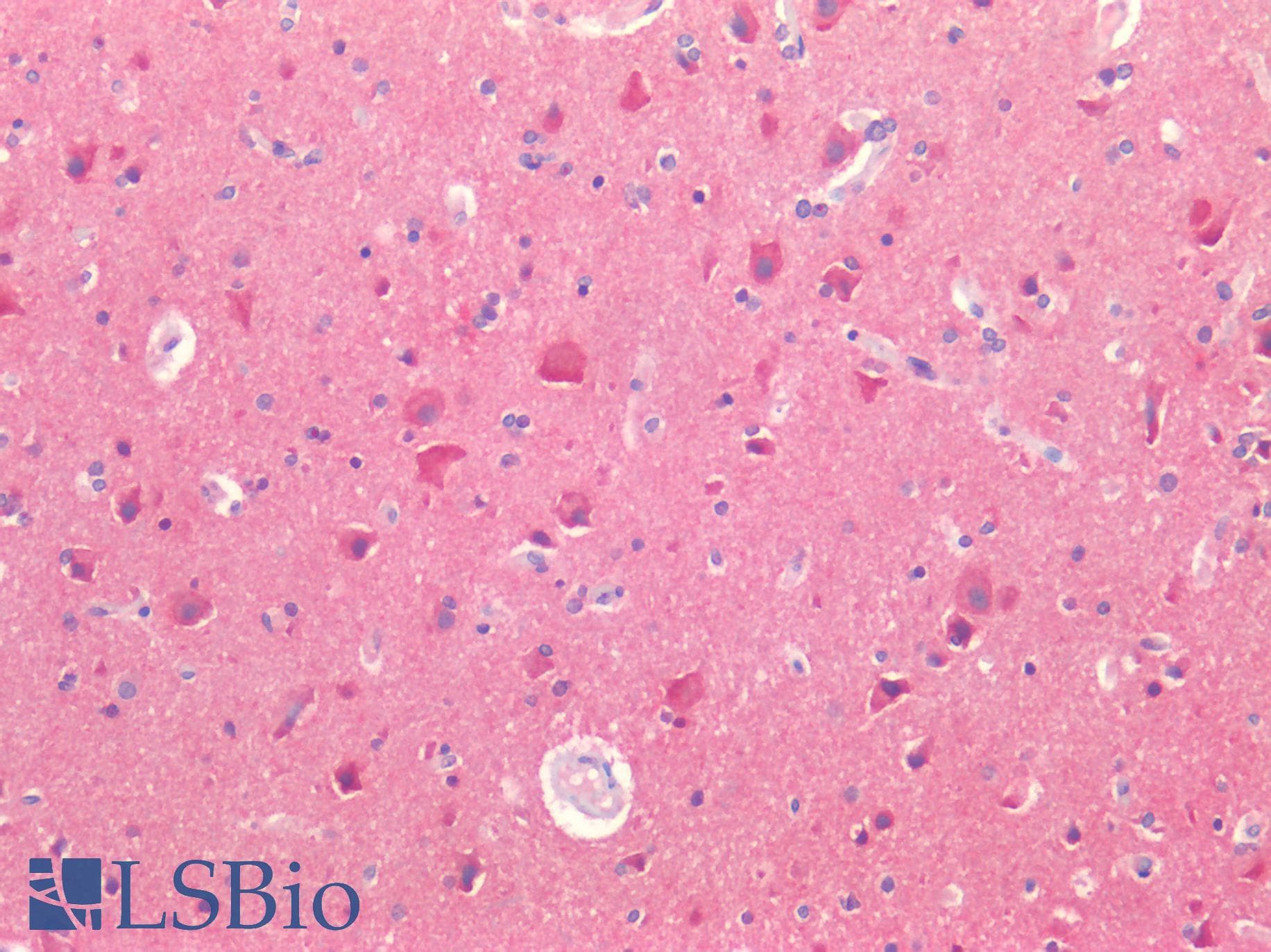 PathPlus™ Polyclonal Rabbit anti-Human KCNA2 / Kv1.2 Antibody (IHC, IF, WB)