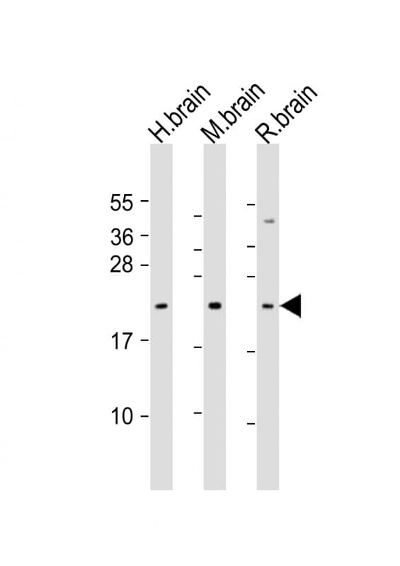 FGF12 Antibody (aa159-191)