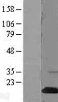 Human SH2D1A / SAP Protein (Over-Expression Lysate Myc-DDK (Flag))
