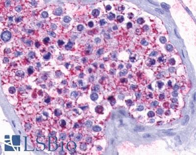PathPlus™ Polyclonal Rabbit anti-Human OPN5 / Neuropsin Antibody (Transmembrane Domain, IHC)