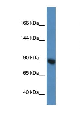AGO3 / EIF2C3 Antibody (aa160-209)
