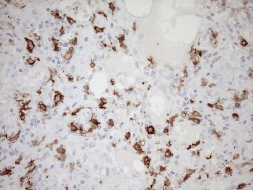 FBP / FOLR2 Antibody (aa20-221, clone OTI8G1, Carrier-free)