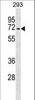 Polyclonal Rabbit anti-Mouse TGFBR2 Antibody (aa548-575, WB)